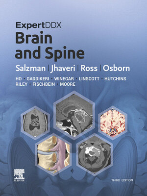 cover image of Brain and Spine